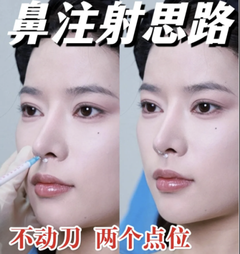 做注射隆鼻可以順便打鼻基底和眉骨嗎？需結(jié)合個(gè)人面部基礎(chǔ)來評(píng)估