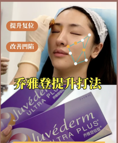 喬雅登打提升效果明顯嗎？不同系列的提升效果有差異
