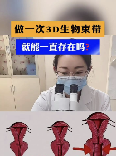 3d生物束帶緊縮術(shù)能維持幾年？本文將為你深入剖析這一疑問