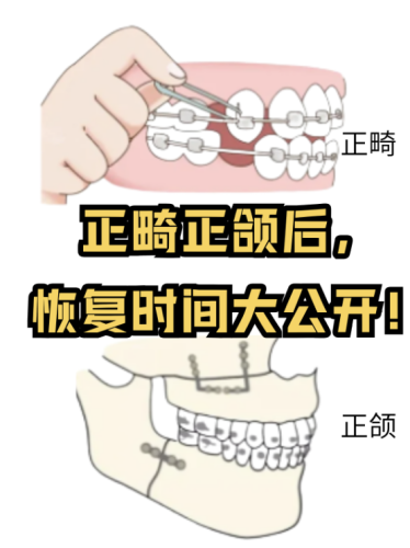 做正頜手術(shù)的十大忠告：能幫你少走不少彎路