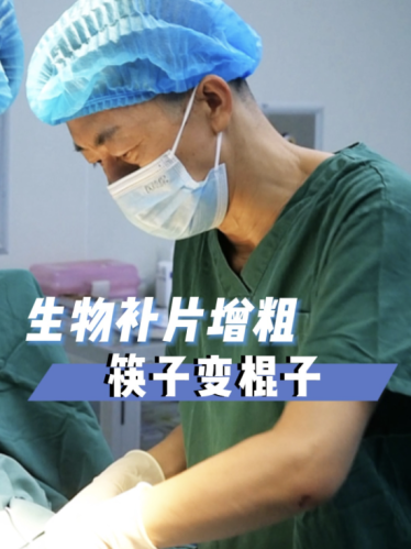 生物補(bǔ)片6x8能增粗多少？醫(yī)生技術(shù)是王道