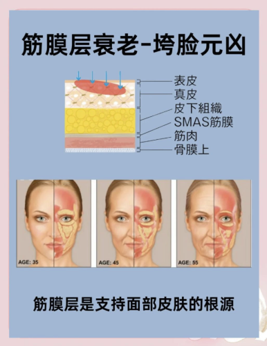 筋膜提升能維持多久？提前到正規(guī)醫(yī)院面診，了解自身情況后再做決定