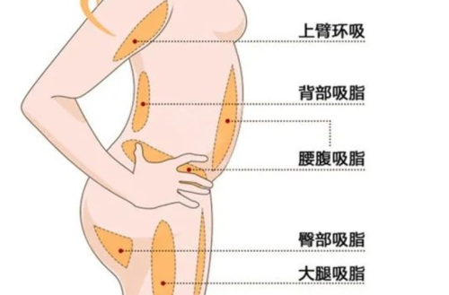 煙臺煙臺山醫(yī)院吸脂多少錢？價格、專家與注意事項