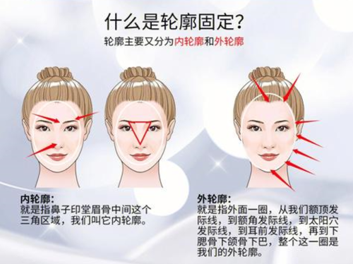 外輪廓固定需要多少錢，內(nèi)行人教你算明白