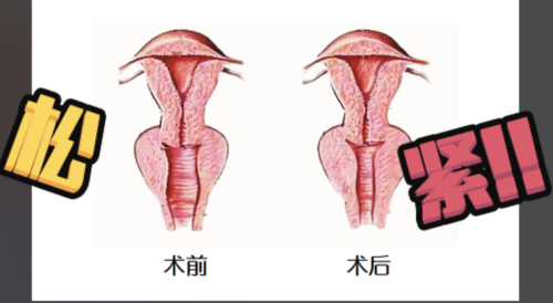 國(guó)藥東風(fēng)總醫(yī)院私密整形怎么樣？妥妥的“別人家的醫(yī)院”！