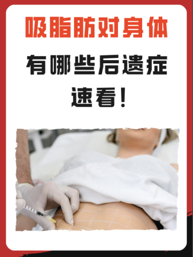 抽脂有什么風險和后遺癥？速看，真的不是開玩笑的