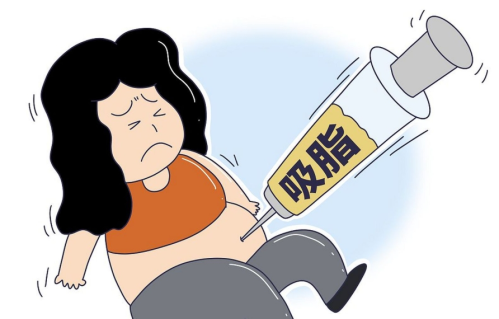 柳州人民醫(yī)院吸脂多少錢？醫(yī)院整形科技術(shù)、掛號全攻略