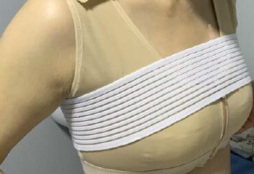 做乳房懸吊術(shù)后胸會(huì)變小嗎?答案比你想的更復(fù)雜