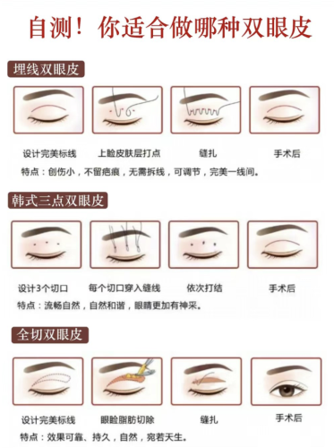 廣西民族醫(yī)院割雙眼皮多少錢？為大家對比一下三種手術(shù)方式的價格和特點